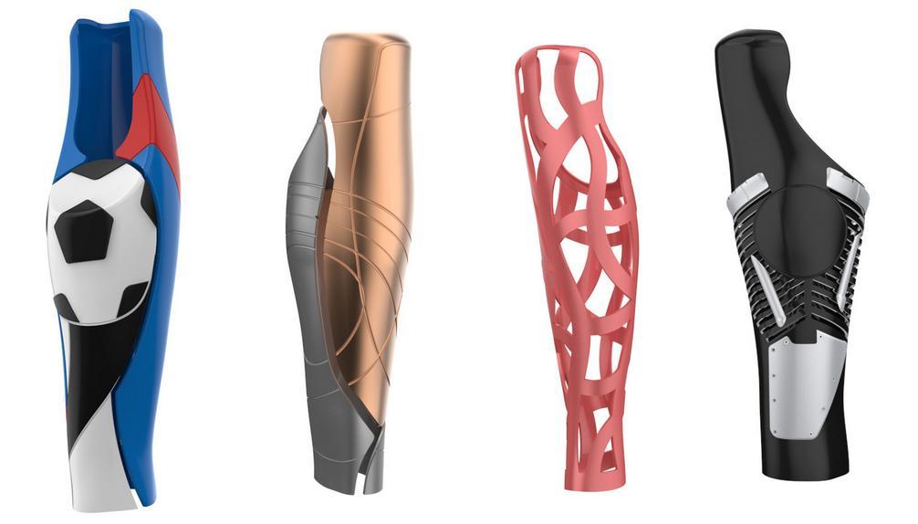 3D Art Meets Prosthetics: Student Creates Beautiful 3D 