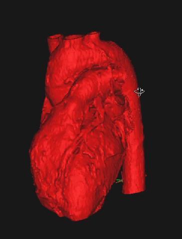 3D Model of Human Heart Use for Printing