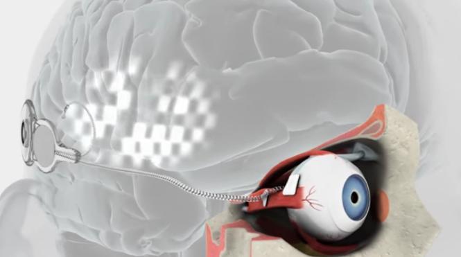 Bionic Eye Cerca cerca di restituire la vista alle persone con deficit visivocon la stampa 3D