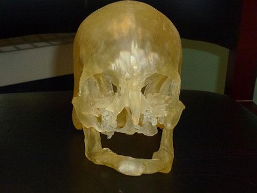 La stampa 3D in ausilio alla chirurgia per i trapianti di volto