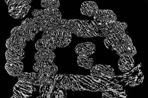 Microtomografía computerizada de un armazón de hueso impreso en 3D. Fuente: <a href="http://3dprint.com/118059/3d-printed-bone-implants/">3dprint.</a>