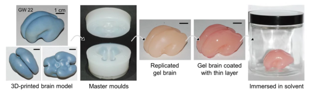 The 3D printed foetal brain.