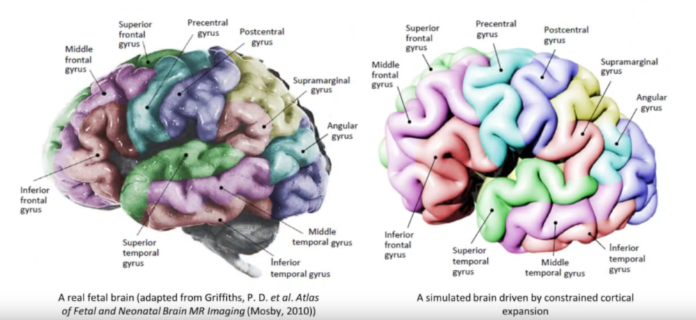Comparisons between a real brain and a brain produced via a simulation. 