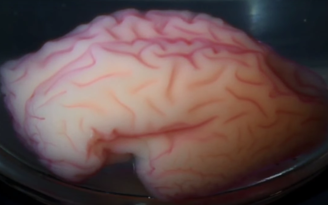 3D Printing Helps Researchers Discover Why the Human Brain Has a Folded Structure