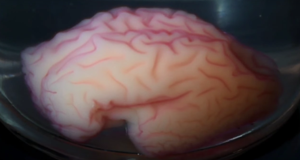 The 3D printed brain during the formation of the simulated brain folds.