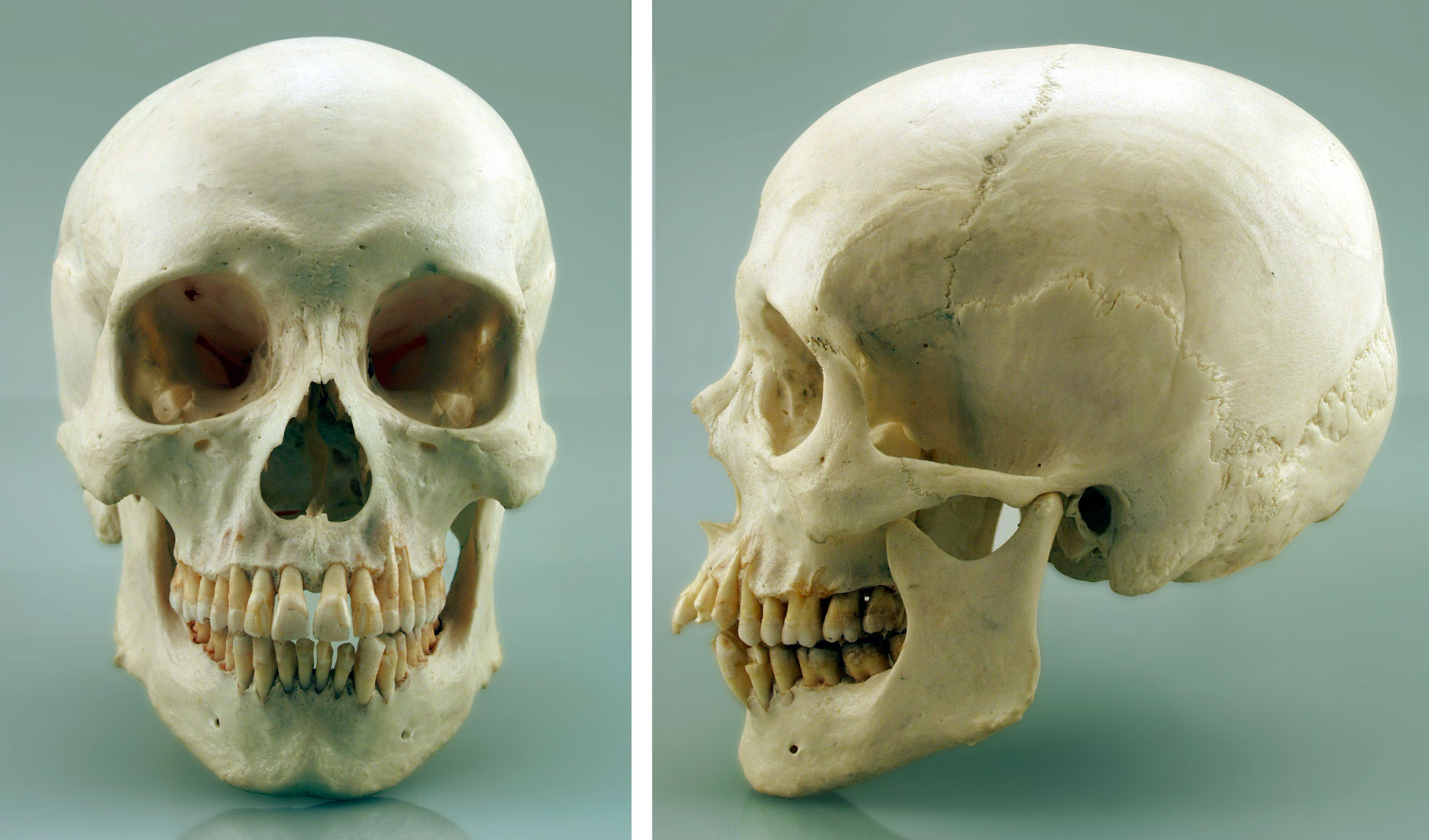 Patient in Argentina Receives 3D Printed Titanium Skull Implant - 3DPrint.c...