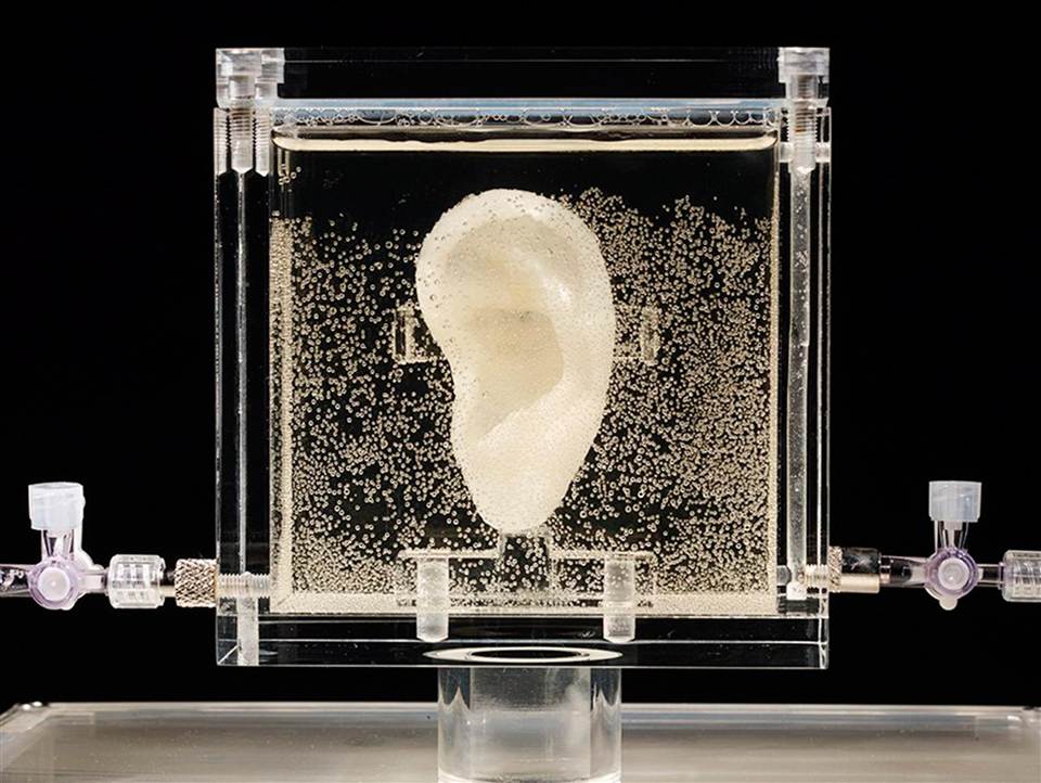 The 3D printed ear of Vincent van Gogh