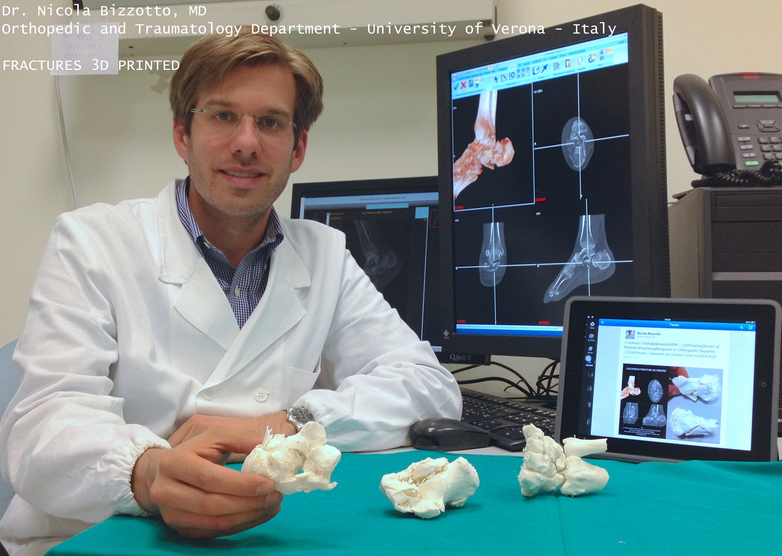 Dr. Bizzotto and his 3D printed bone replicas