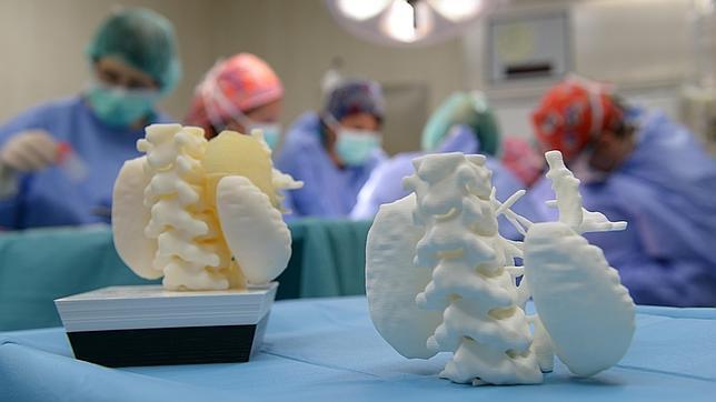 The 3D Printed Tumors (with organes) - image credit - abc