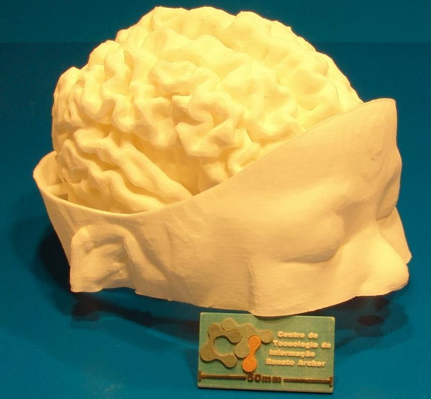 3D printed model of the child's brain, by CTI (image provided to 3Dprint.com by Jorge Vicente Lopes da Silva)
