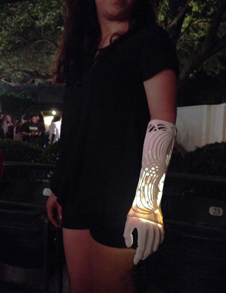The 1st Iteration of Ivania's Prosthetic Arm.