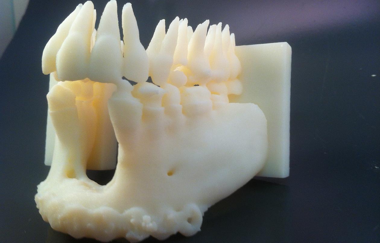 Stratasys 3D printed mandible model showing detail a surgeon cannot see with just a CT scan