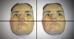 Cosmetic Surgeon 3D Prints Incredible Before and After Masks for a Rhinoplasty Patient