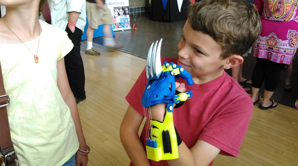 What Disability? I'm a Super Hero! The 3D Printed Prosthetic Wolverine Hand is Here!
