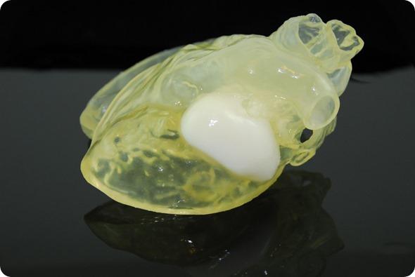 Bradley White's 3D printed heart and tumor