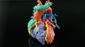 Materialise's 3D Printed Cardiovascular HeartPrint® Models Now Listed ...