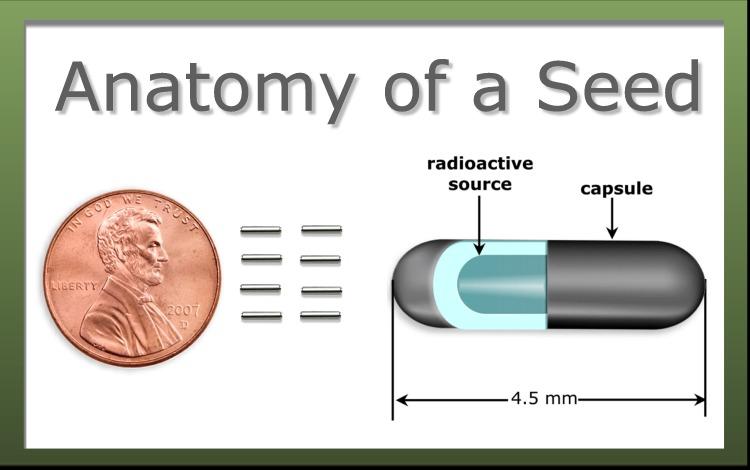 The Anatomy of a radioactive seed (image source: drrichardstock)