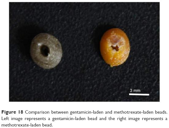 gentamicin-laden and methotrexate-laden beads