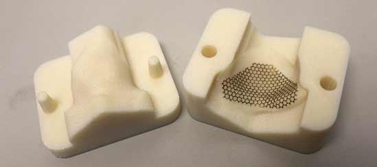 3d-printed-orbital-implant-mold