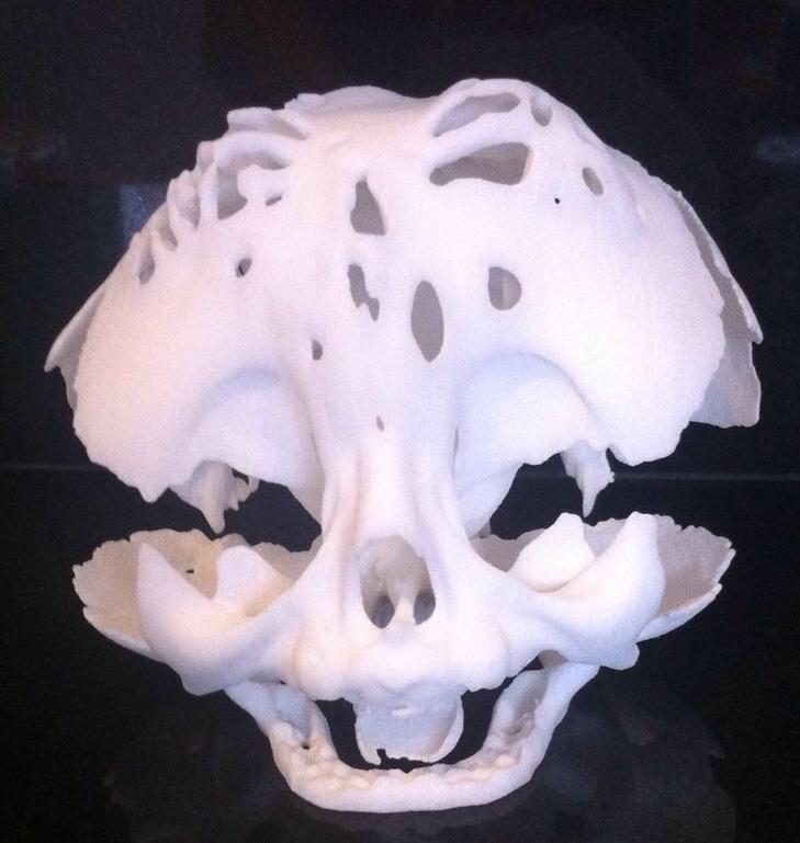 3D Printing Saves the Life of a Newborn with Cloverleaf Skull Syndrome