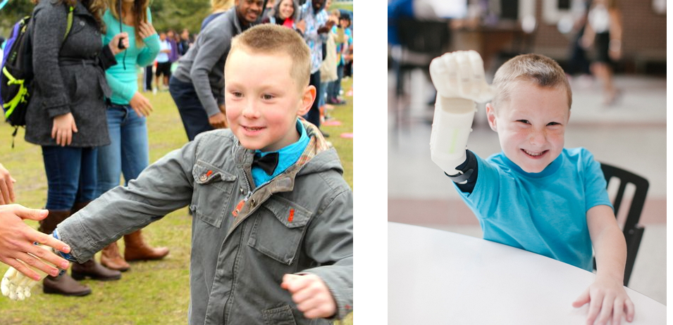 Attempt to Break Guinness Record of 1,647 High-Fives Falls Short, But Brings Attention to 3D Printed Prostheses