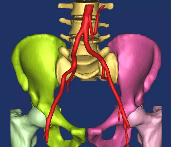 This picture shows the normal hip