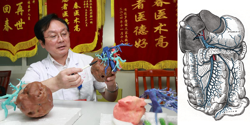 3D Printed Liver Model Saves Man’s Life in China