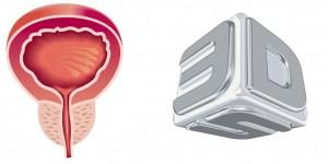 3D Systems Announces First Virtual Reality Robotic Prostatectomy Training and Soft Tissue Model
