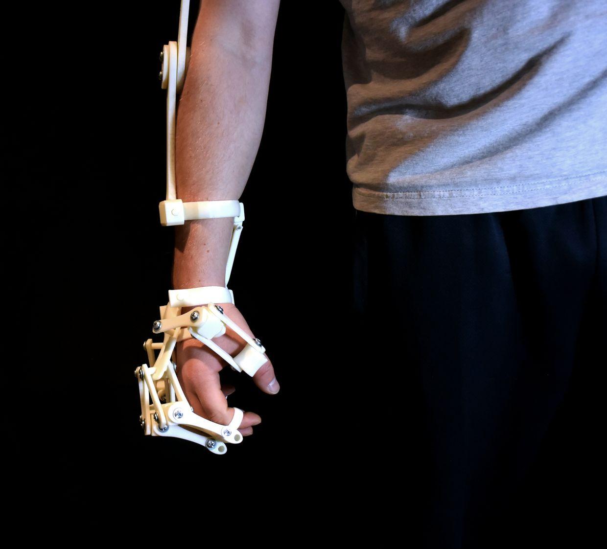 Alex Czech's 3D Printable Exoskeleton Hands are Now Extended to Arms - 3DPrint.com | The Voice of Additive Manufacturing