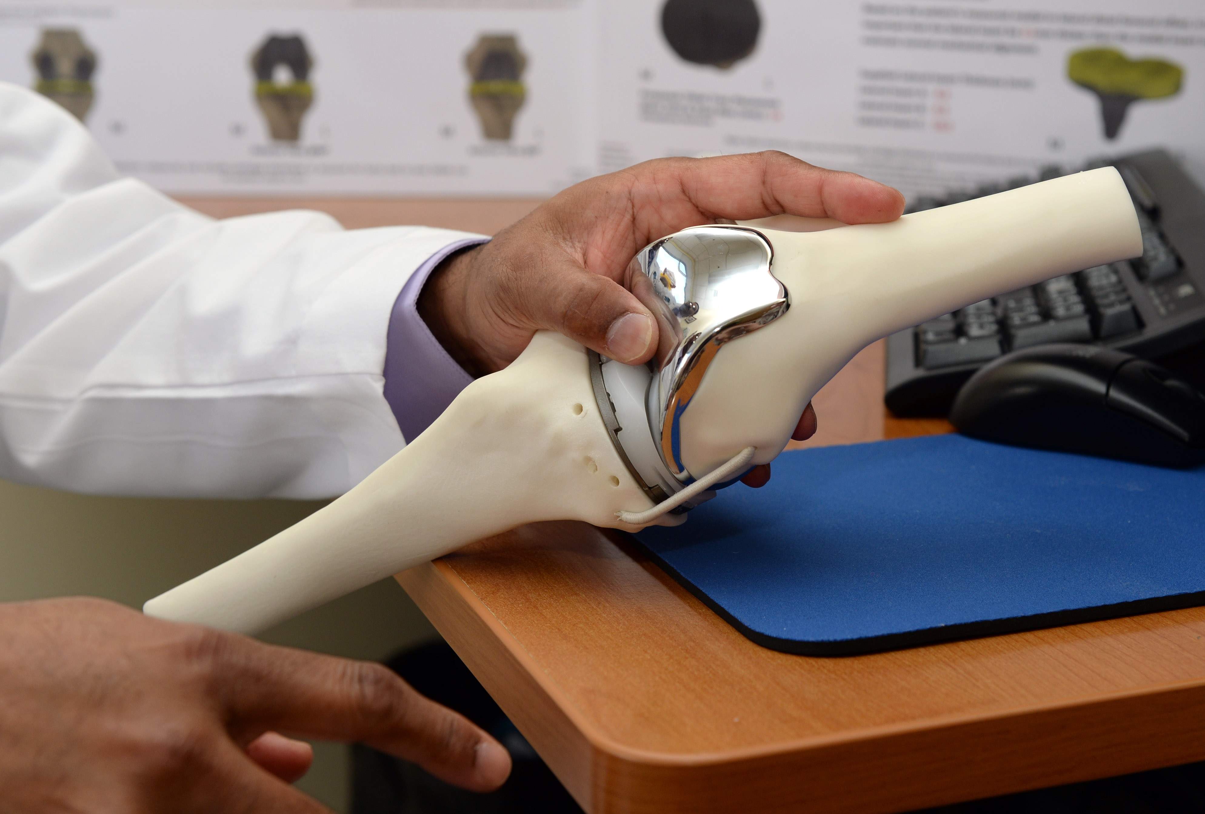 3D Printed Knee Replacement Surgery Enables 85-year-old Woman to Walk ... - Knee2