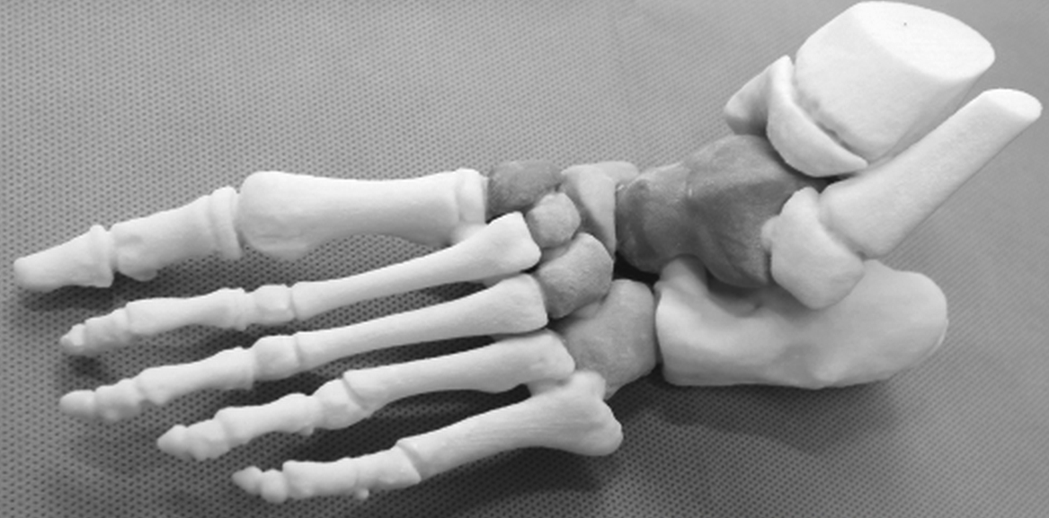 Напечатанные кости. 3д принтер костей. Имплантаты на 3д принтере. 3d-биопринтинг кость. Кости на 3d принтере.