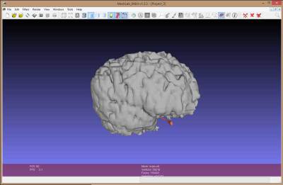 meshlab brain scan file
