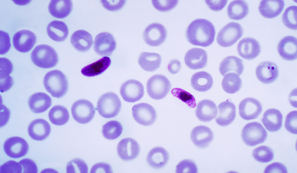 Malaria parasites infecting red blood cells. 
