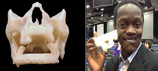 3D Systems and 3D Printing Aid in the Effort to Reconstruct Young Zimbabwean Man’s Face