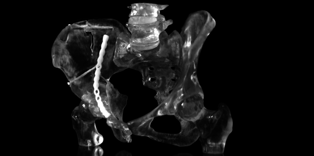 Translucent pelvis with flexible spinal disc and implant. See this story: https://3dprint.com/44173/3d-printed-anatomy-models/ 
