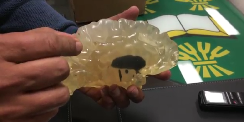 First Realistic Brain Model 3D Printed to Aid with Surgical Procedure