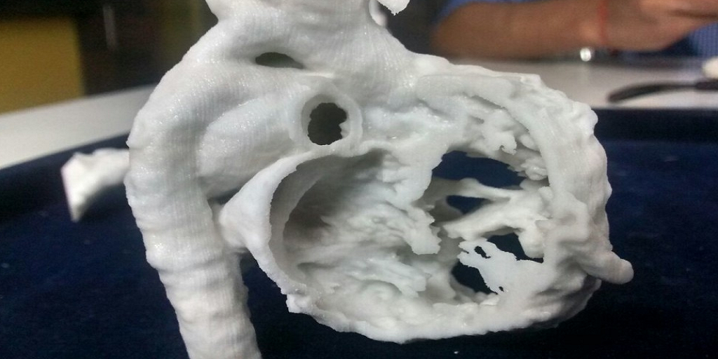 India’s Pediatric Heart Patients Have More Hope Than Ever Thanks to 3D Printing