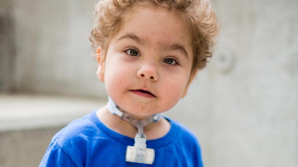 How-3D-printed-devices-saved-three-babies-lives-at-Mott