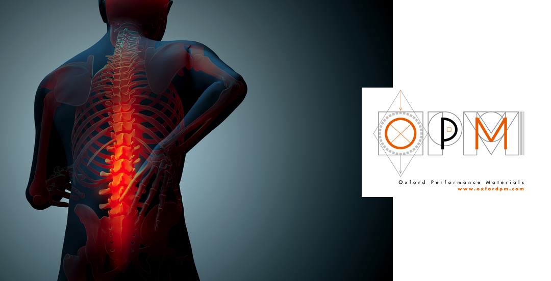 3D Printed Spinal Implants: RTI Surgical Granted Exclusive License to OPM OsteoFab Technology Platform