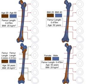 Femur geometry based on age, height, gender and BMI