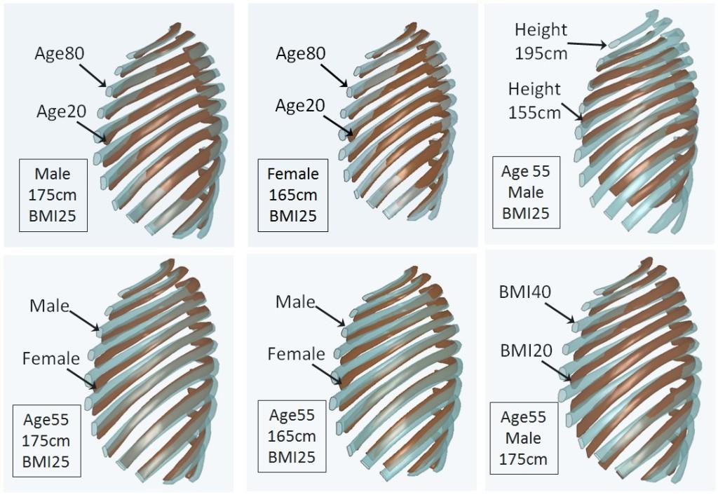 Rib cage geometries based on gender, age and BMI