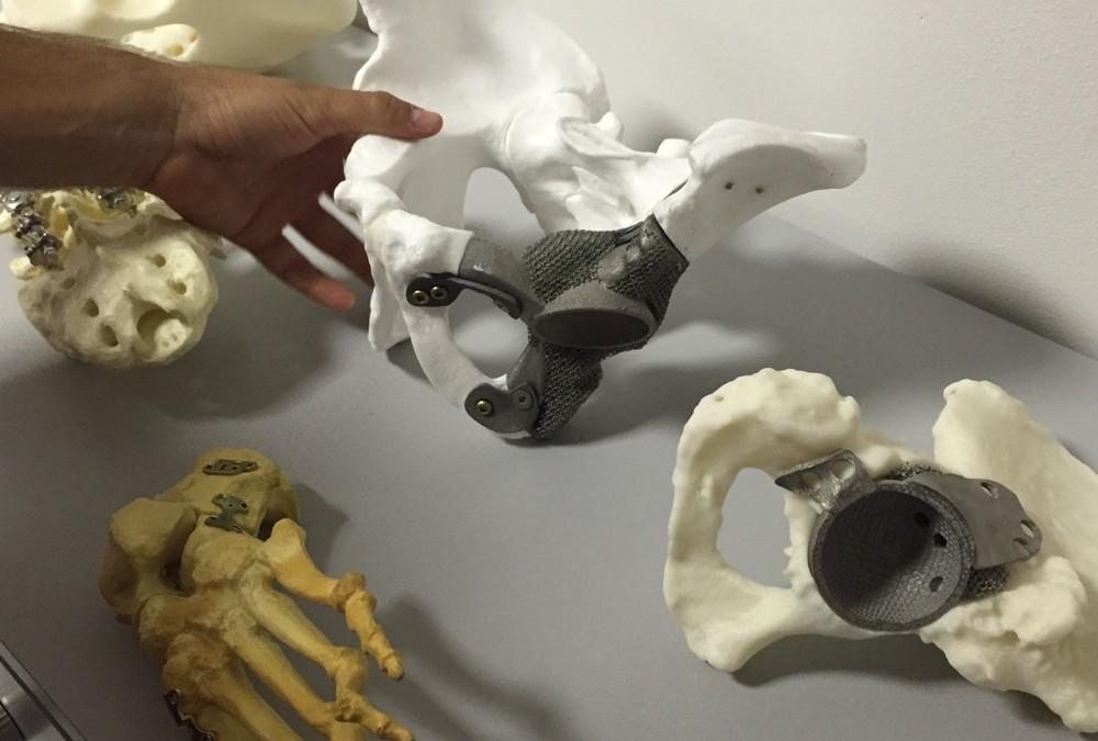 A collection of 3D printed bone implants in titanium.