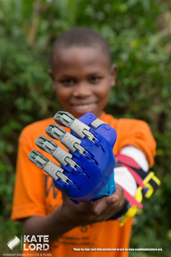 Amos, a student at Arlington Academy of Hope in Bududa district of Uganda, receives a prothetic arm that was 3D printed for him at Marymount University. (photo by Kate Lord)