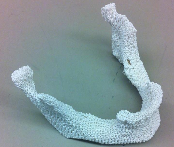 3D printed bone scaffold made of effortless bone powder and biodegradable polyester material polycaprolactone.