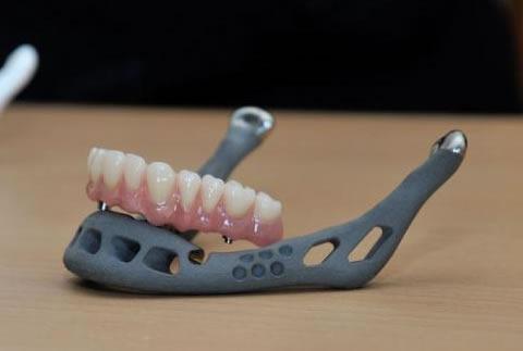 Carnegie Mellon University Research May Lead to Enhanced Design to Reduce Porosity in 3D Printed Titanium, Leading to Stronger Parts