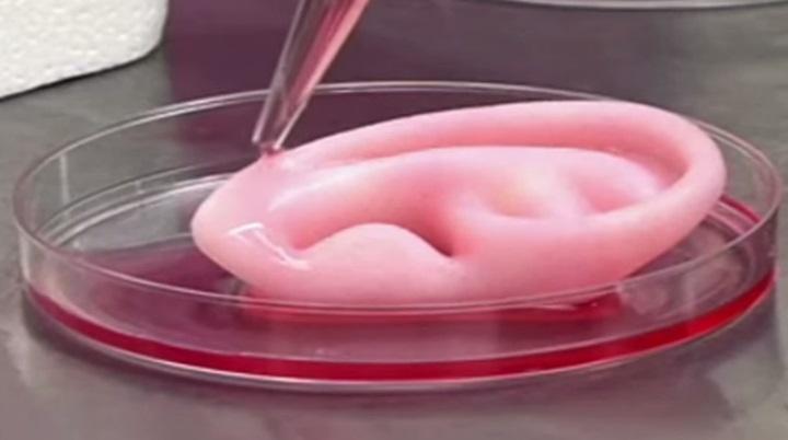 3D bioprinting is a rapidly expanding segment of the healthcare 3D printing market. 