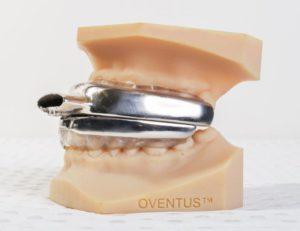 The O2Vent is customized to each individual users mouth and then 3D printed in titanium.