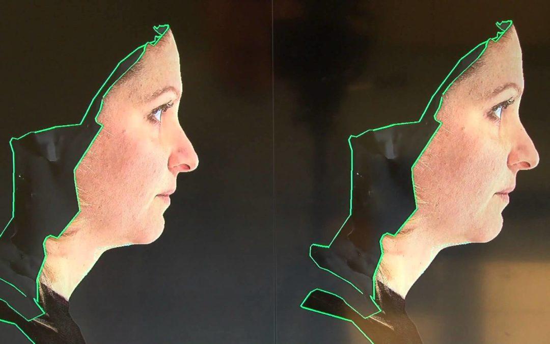 3D Imaging Utilized in Study to Prove Genes Influence Facial Appearance