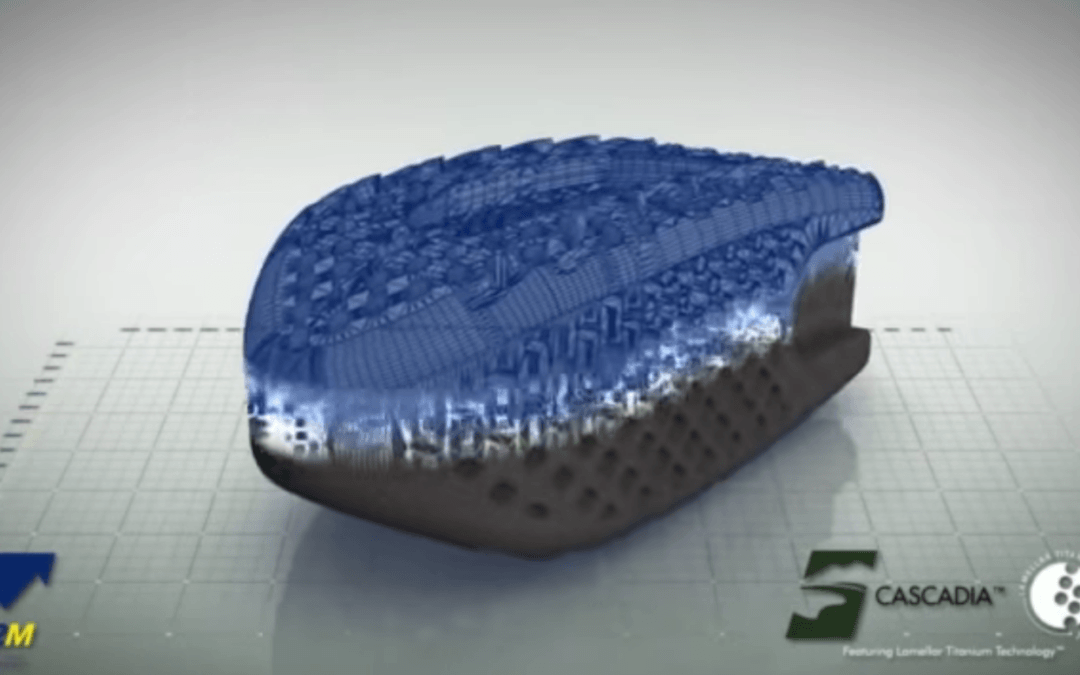 K2M Announces US Launch of 3D Printed Titanium Spinal Solutions For Clinical Usage
