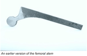 An earlier version of the femoral stem